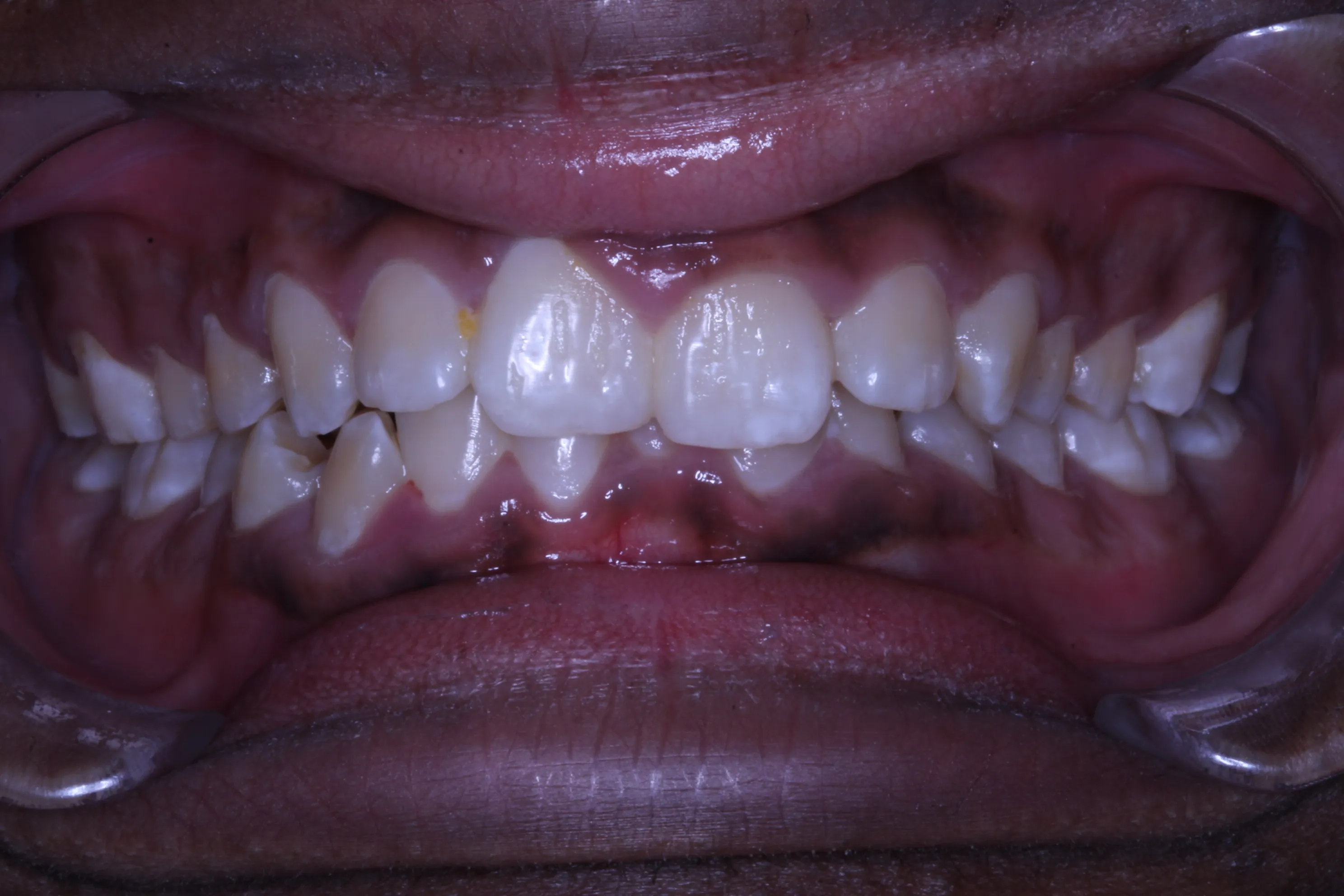 smile-gallery gallery